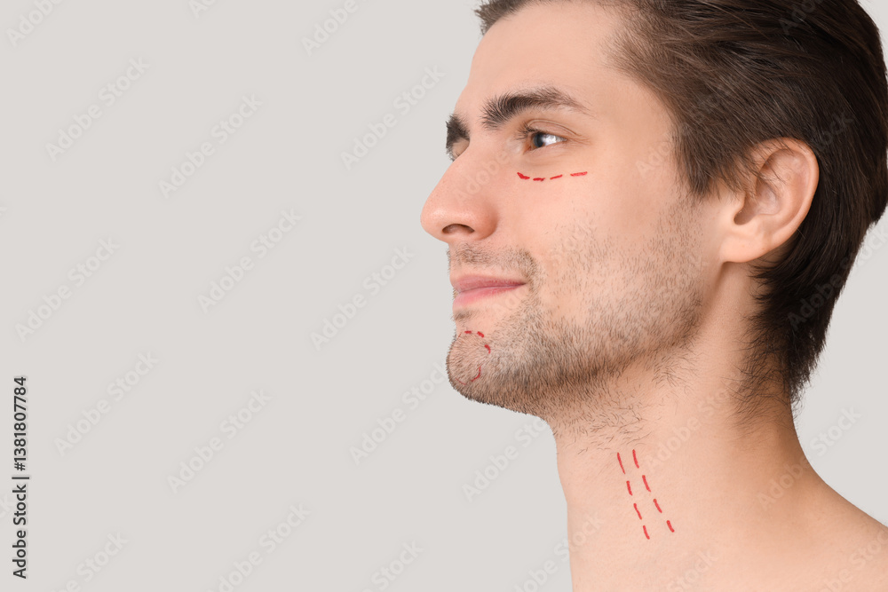 Obraz premium Young man with marked face on light background, closeup. Plastic surgery concept