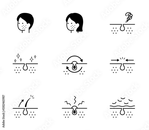 ニキビに関するアイコンイラストセット　ベクター
