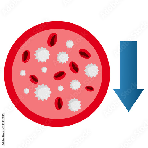 Thrombocytopenia flat Illustration