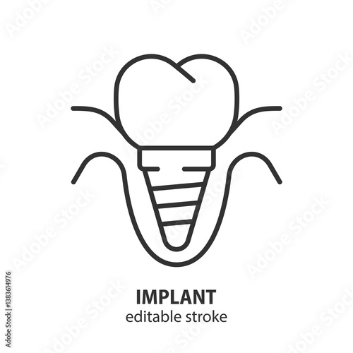 Dental implant line icon. Implantation symbol. Vector illustration. Editable stroke.