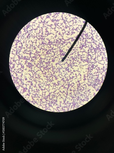 Microscopic view of Gram-positive bacteria stained for microbiological analysis. Useful for science, healthcare, and laboratory-related content focusing on bacterial structure and identification. photo