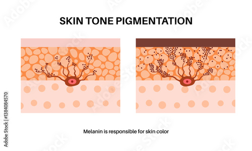 Melanin and melanocytes