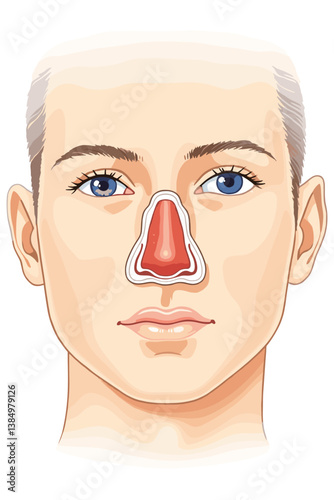 Vibrant Vector Illustration of a Deviated Nasal Septum in a Human Face, Showing Cross Section. Medical Diagram for Educational Purposes. Includes Nose Anatomy