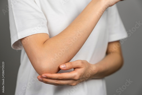 woman has a red mark on her elbow, Caused by itching due to insect stings or chemical allergies