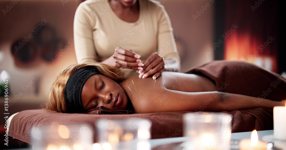 Photo Title: Female Acupuncturist Performs Dry Needle Treatment