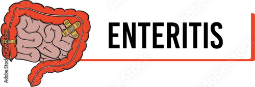 enteritis