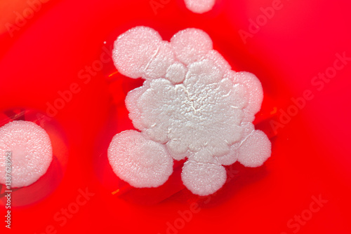 Obraz na płótnie Mold fungi colonies grown from indoor air on blood sheep agar w salonie