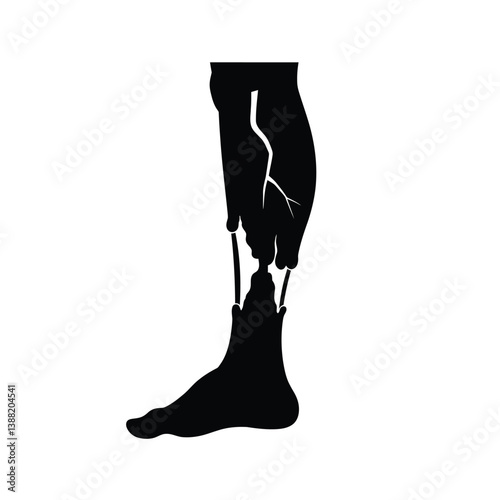 Silhouette vector illustration of a Rotting Leg icon on a white background 