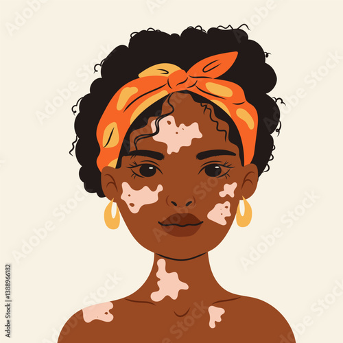 Portrait of a happy dark skinned woman with vitiligo, promoting self acceptance and body positivity . Diverse beauty , hand drawn illustration in flat style isolate on white .