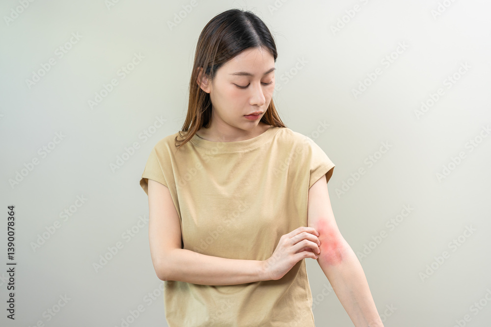 Obraz premium Dermatology asian young woman, girl allergy, allergic reaction from atopic, insect bites on her arm, hand in scratching itchy, itch red spot or rash of skin. Healthcare, treatment of beauty.