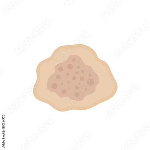 Melasma Skin Pigmentation. Dark Spot Treatment Illustration Design.