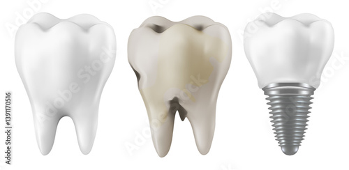 Dental dentists treat teeth decay teeth decay treatment concept. remove plaque, Tooth loss and dental implants . medical apps, websites and hospital. 3D Mesh gradient wes