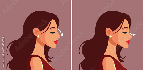 Profile of a Woman Getting Plastic Surgery on her Nose Vector Illustration. Person before and after a cosmetic surgical procedure 
