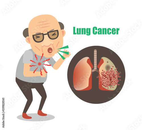 Lung Cancer Illustration