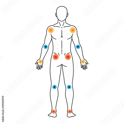 Body Pain Points: A comprehensive medical illustration displaying highlighted pain points on a human figure, emphasizing key areas affected by ailments.