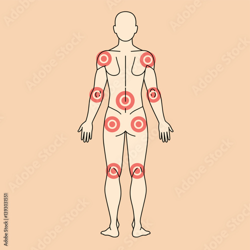 Body Pain Points: A detailed illustration of human anatomy highlights specific areas of discomfort, perfect for medical or wellness-related content.