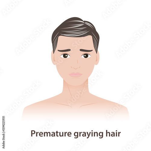 Premature graying is hair problems for men illustration. The man with early loss of natural hair color, before the age of 30, can be influenced by genetics, ethnicity, lack of vitamin and mineral.