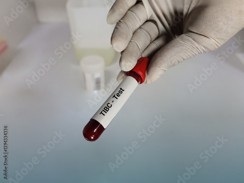 Doctor hold blood sample for TIBC test. Iron deficiency anemia, Transferrin. Medical test tube in laboratory background.		