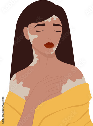 Young woman illustration with vitiligo. World Vitiligo Day. Selfcare concept. Simple cartoon style illustration