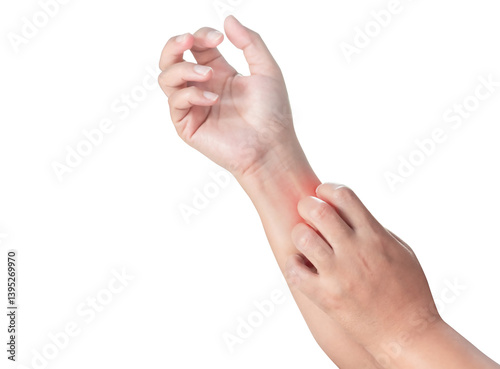 Close up woman's arm scratch the itch by hand at home, itching due to rash, fungus, allergy, dermatological disease, dry skin. Healthcare and medical concept. isolated on transparent background, PNG