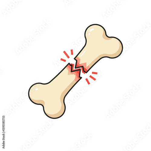 Broken Bone: An illustration of a fractured bone, showcasing a visual representation of a break with lines and visual cues, capturing the essence of bone fractures.