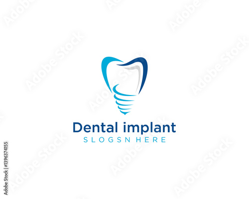 Dental implant logo