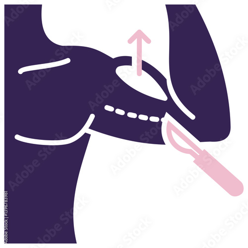 Implant Icon