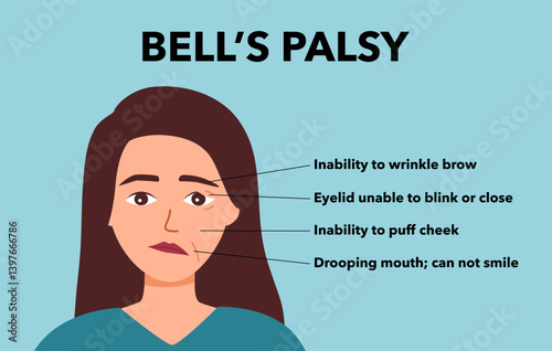 brow, lyme, vesicle, neuropathy, bell, geniculate, infection, ear, disease, cholesteatoma, droopy eyes, bell's palsy, injury, neuropathic pain, cervical, localized, asymmetric, autonomic, traumatic, m