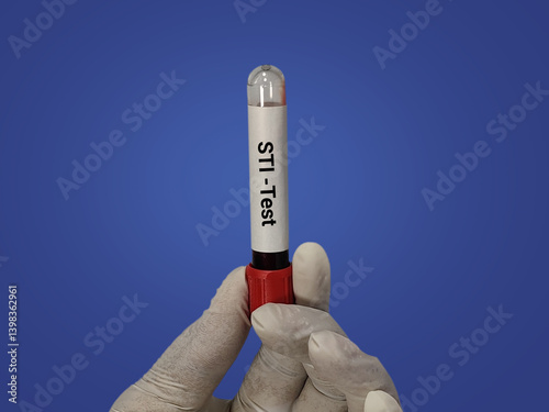 Doctor hold blood sample for STI (Sexually Transmitted Infection) test with laboratory background. 