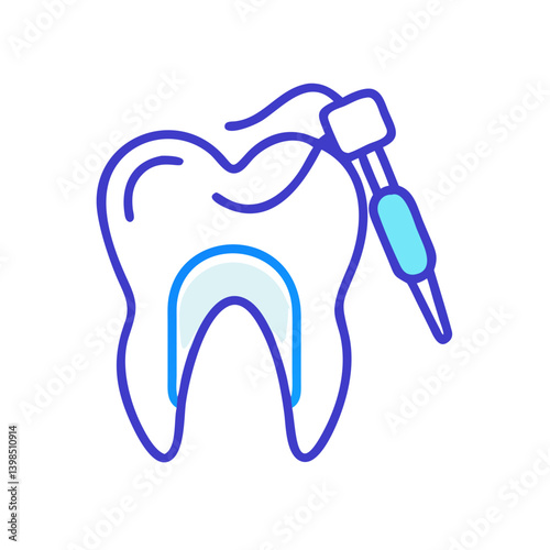  Endodontics Dental Procedure Illustration
