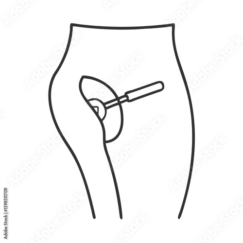 Advanced Femoral Introducer Sheath