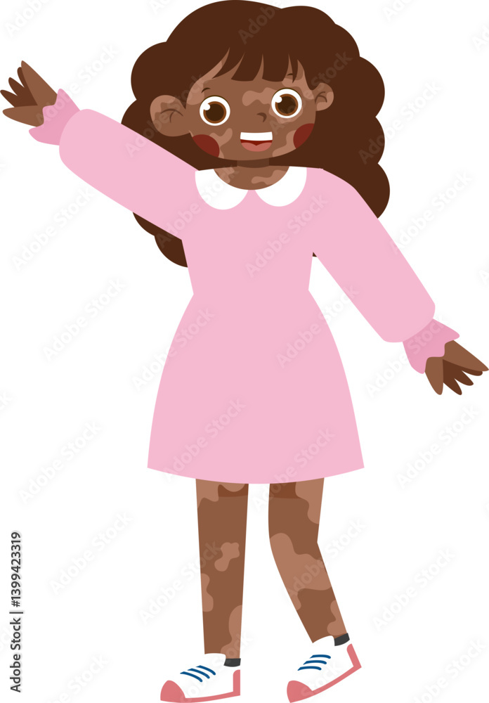 Joyful Girl with Vitiligo in Pink Dress, Arm Raised Joyful Girl with Vitiligo in Pink Dress, Arm Raised