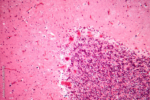 Obraz na płótnie Human motor cortex, photomicrograph showing pyramidal neurons in cortical layers responsible for voluntary movement control and motor coordination