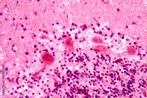 Human motor cortex, photomicrograph showing pyramidal neurons in cortical layers responsible for voluntary movement control and motor coordination.