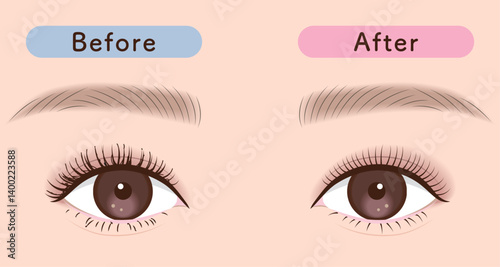 ひじきまつ毛から理想の束感へ｜まつ毛のBefore→After素材