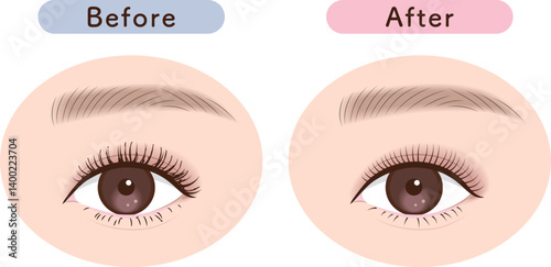 ひじきまつ毛から理想の束感へ｜まつ毛のBefore→After素材