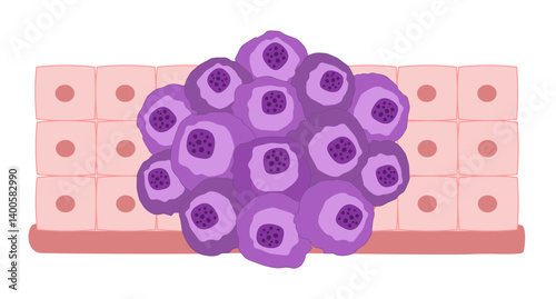 Cancer cell on a white background with blood vessels along with normal cell illustration