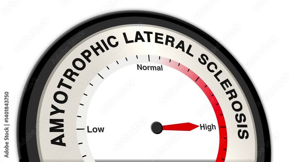 Amyotrophic Lateral Sclerosis (ALS) text or word displayed with a ...