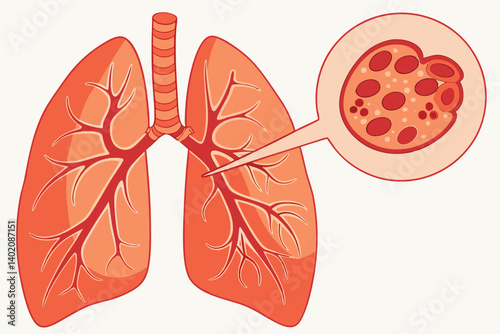 Adobe Ill54 Medical illustration, human lungs, microscopic view of blood vessel, cancer cells, 3D rendering, detailed anatomy, orange and red color palette, scientific diagram, cellulaustrator Artwork