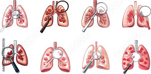 Vector Illustrations of Lungs Analyzed With Magnifying Glasses for Various Conditions