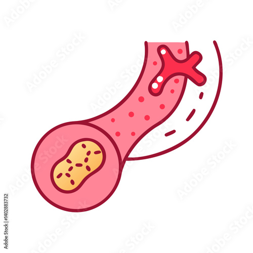 Artery with Blockage Icon Representing Vascular Obstruction and Circulatory Disorders