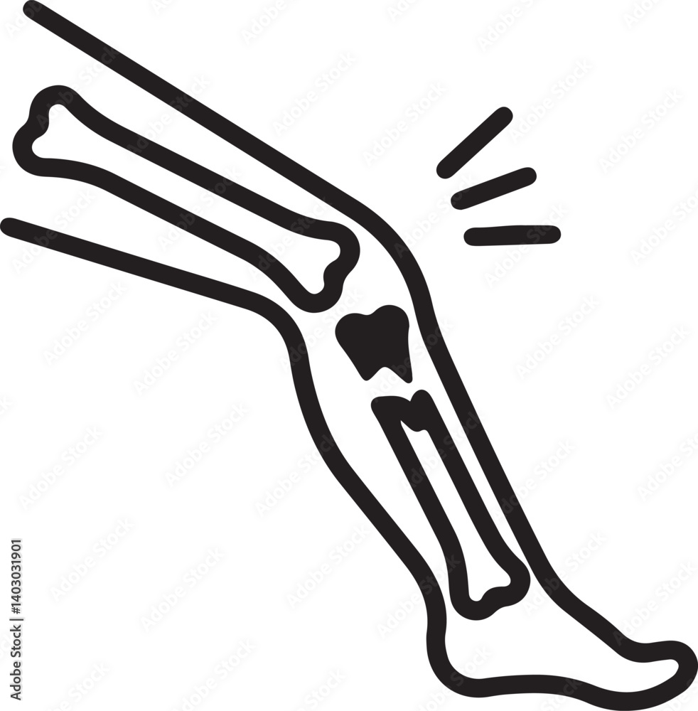 an illustration of a broken knee bone