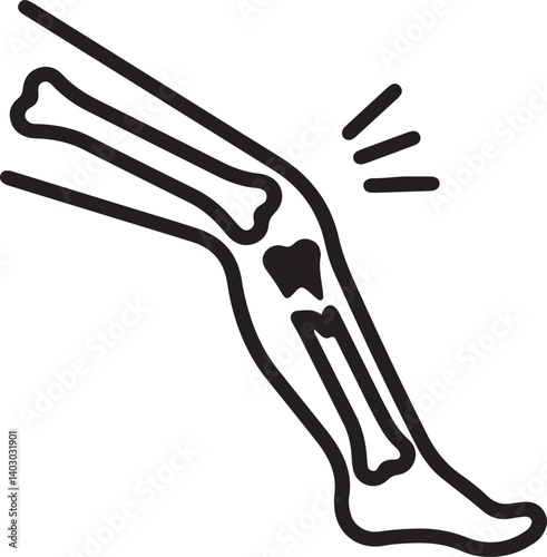 an illustration of a broken knee bone