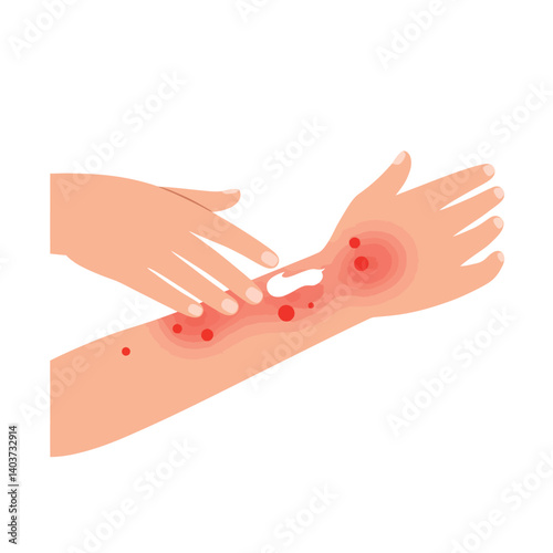 Skin irritation depicted in flat vector art showing before and after treatment stages