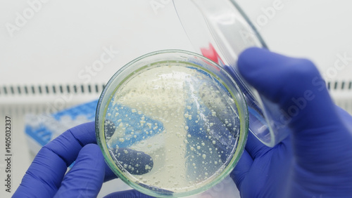 Opening a petri dish containing bacterial colonies in a sterile laboratory environment.