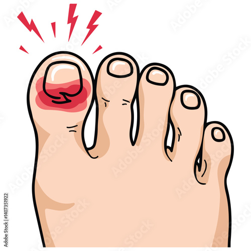 swollen inflamed big toe cartoon style isolated vector illustration on white background