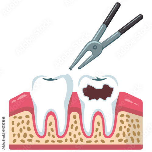 dental forceps extracting human tooth isolated vector illustration on white background