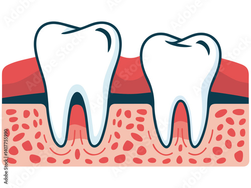 wisdom tooth pushing adjacent molar isolated vector illustration on white background