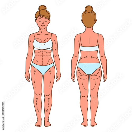Female Body Liposuction Markings Front and Back. Vector illustration showing front and back view of a womans body with marked areas for liposuction and body contouring