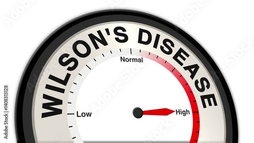 Wilson's disease text with a barometer or tachometer-style gauge, illustrating varying levels of copper accumulation and damage to organs, such as the liver and brain photo
